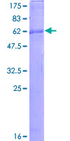 12.5% SDS-PAGE Stained with Coomassie Blue.
